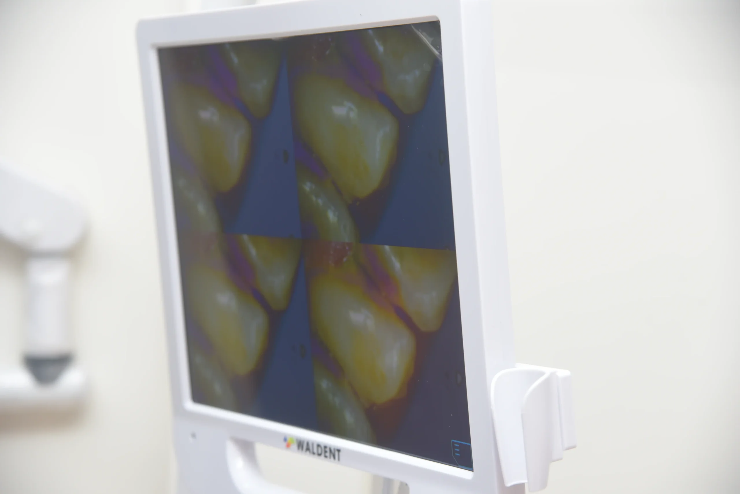 Best Dental Studio In Ahmedabad by Dr Ishita Popat