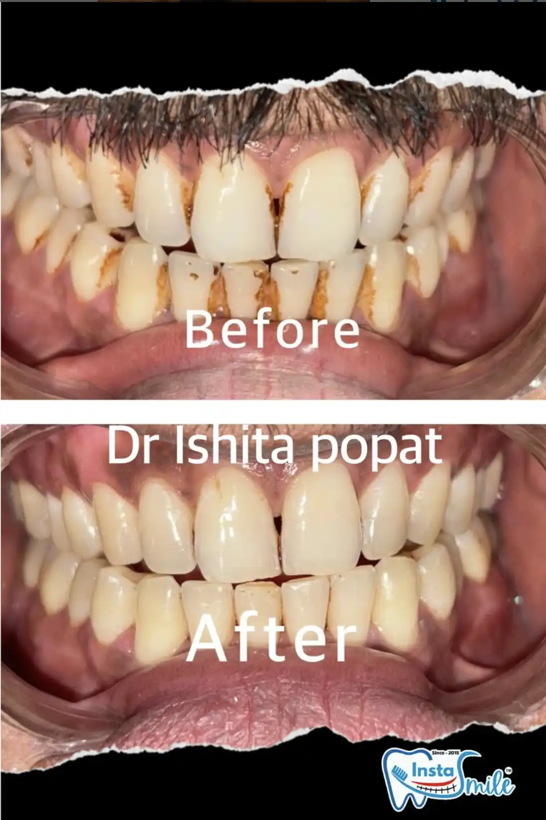 InstaSmile Dental Studio by Dr Ishita Popat, Ahmedabad
