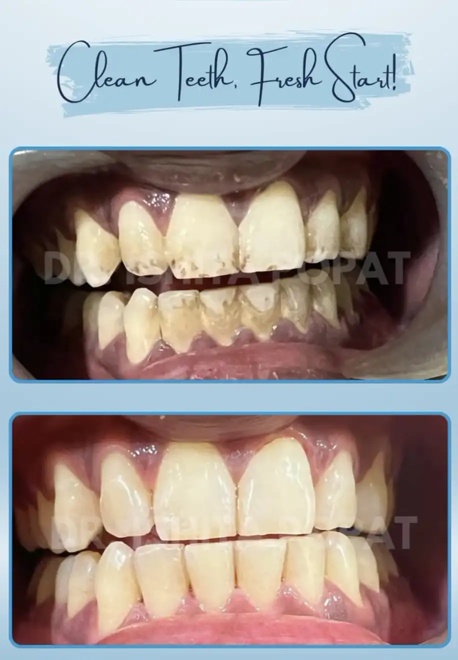 Best Dental Clinic in Ahmedabad, InstaSmile Dental Studio
