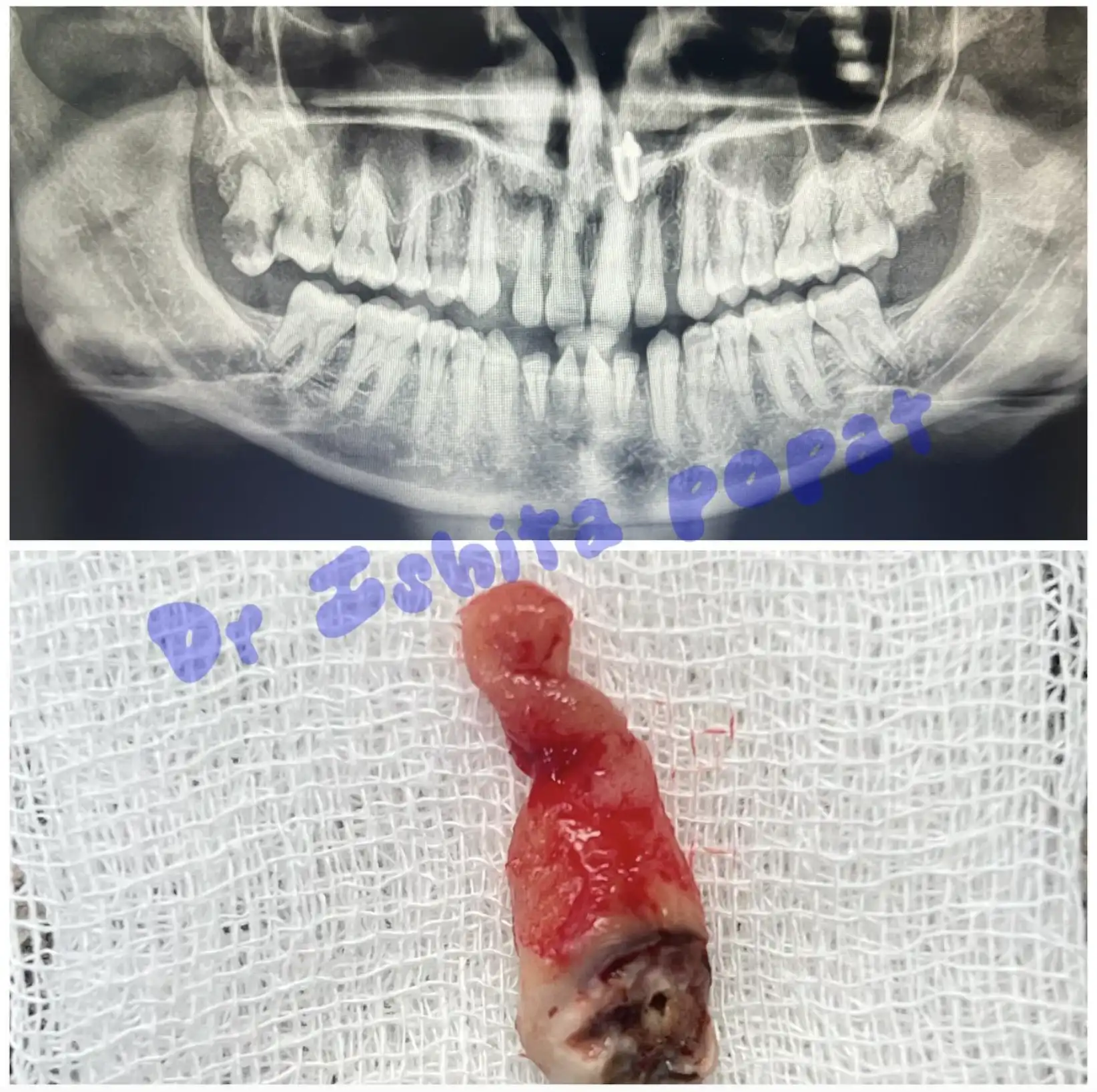 Best Dental Clinic Near Me, Ahmedabad - Dr. Ishita Popat